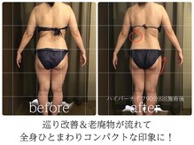 ライフチャージ(Life Charge)/ハイパーナイフBefore→After