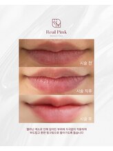 アネラ(ANELA)/Real Pink