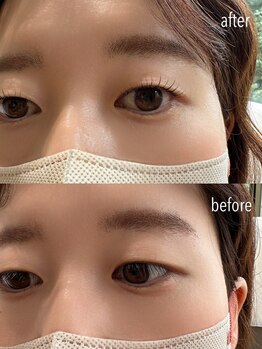 シューナランド(schoner Rand)/ラッシュリフト