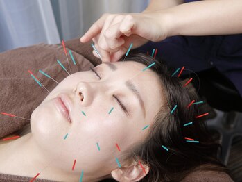 東船橋ひびき整骨院/美容鍼