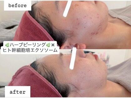 エム シャルール(M chaleur)の写真