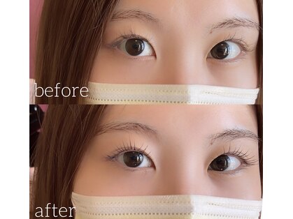 アンテイン(anthein)の写真