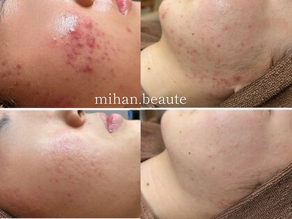 ミハン ボーテ(mihan.beaute)の写真