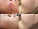 ミハン ボーテ(mihan.beaute)の写真