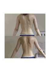 新百合ケ丘の痩身専門エステサロン リリバ(ririva)/ビフォーアフター