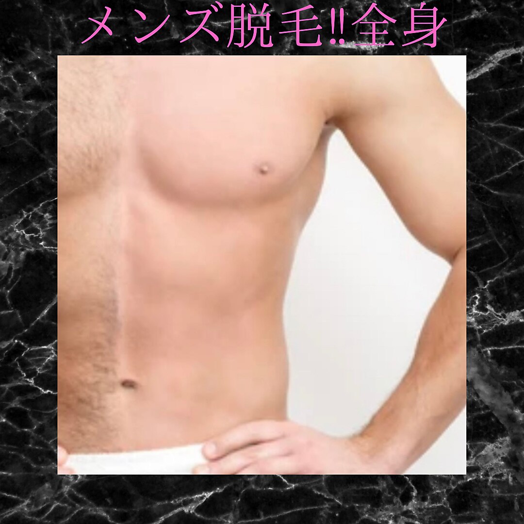 特別価格【メンズ脱毛】全身脱毛　剛毛卒業【顔or VIO】痛みに弱い方必須