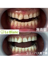 ルブラン 奈良店(Le Blanc)/【60代のお客様】