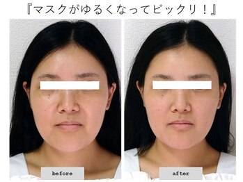 エピファニー(Epiphany)/20代　姉の顔が凄く変わったので