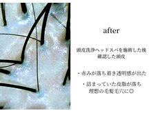 オンビューティーバイコンベックス(On Beauty by convex)/〈アフター〉キレイになった頭皮