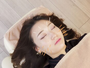 ハリナチュレ 札幌店の写真/【SNSで話題】芸能人も通う美容鍼サロン♪丁寧なカウンセリングで貴方だけの施術を◎[美容鍼/小顔/整体]