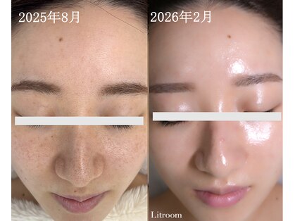 リトルーム(Litroom: from Seoul)の写真