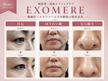 ツキ(TUKI+)の雰囲気（微細針×エクソソームで年齢肌の肌質改善◎韓国発エイジングケア）
