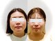 ワカヤマ 小顔(Wakayama)の写真