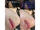 オル(olu)の写真