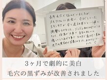 メモリ/お客様のご感想/毛穴ケア