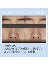 アンジェラックス スキンケアセンター心斎橋/