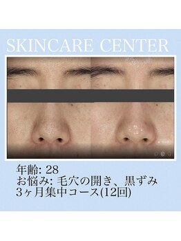 アンジェラックス スキンケアセンター心斎橋/