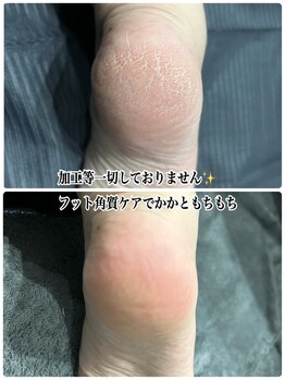 フットケアコースのご紹介★