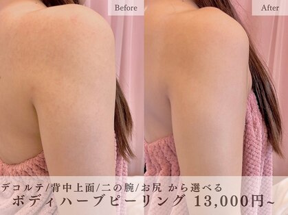 レヴェリー 心斎橋店(REVERIE)の写真