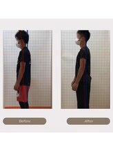 かがわ接骨院 高松伏石院/姿勢の悪さでお悩みの方！