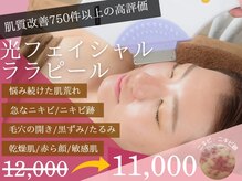 チャパン(Chapan)