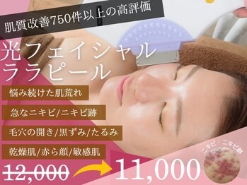 チャパン(Chapan)