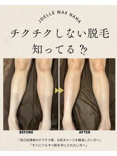ジョエルワックス 沖縄那覇店(JOELLE WAX)/チクチクしない脱毛、知ってる？