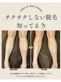 ジョエルワックス 沖縄那覇店(JOELLE WAX)/チクチクしない脱毛、知ってる？