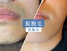 ★朝の髭剃りから解放★ ひげ光脱毛【男性4,000円】