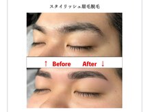 リムーヴ(Re:move)の雰囲気（最新の脱毛機で眉毛もスッキリ脱毛♪）