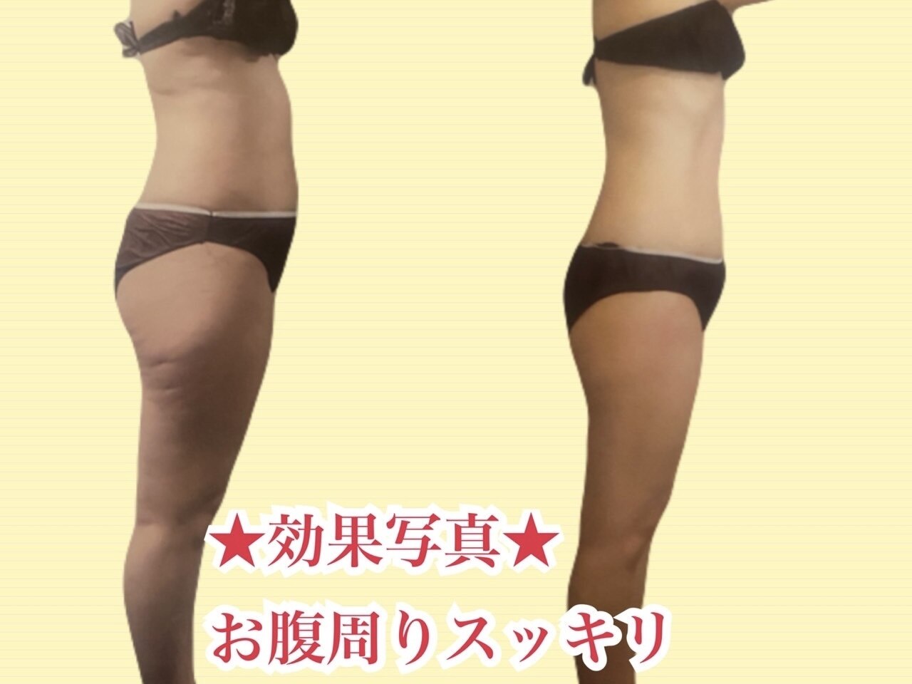 大阪市阿倍野区でキャビテーションが人気のエステサロン