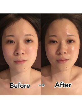 グレースフィオーレ 上野御徒町店(gracefiore)/ビフォーアフター