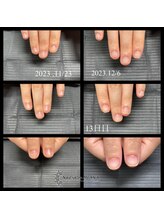 オハナ(OHANA)/自爪育成★爪質改善