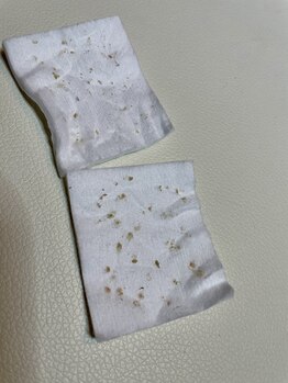 キキ(kiki)/１回でゴッソリ毛穴汚れ