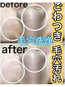 マルサンカクシカク(○△□)/