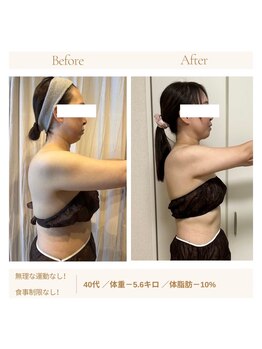 ヨサパーク ドゥー 駒沢公園(YOSA PARK deux)/痩身/ダイエット/よもぎ蒸し痩身