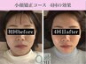 《再来女性の方》小顔頭蓋骨矯正＋リンパケア8回コース￥61600→￥41600