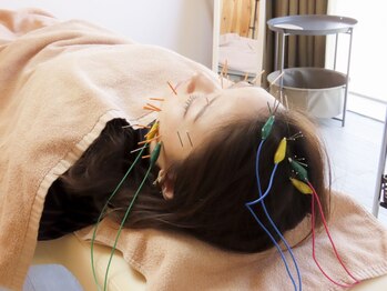 ハリナチュレ 札幌店の写真/慢性的な眼精疲労や肩こりにお悩みの方へ◎鍼施術×整体で体質ケア！[鍼/整体/肩こり]