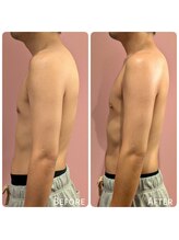 ククナ 上越店(KUKUNA)/30代男性（姿勢矯正１回）