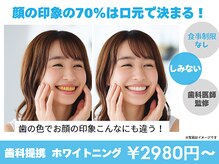 ホワイトニングカフェ 金山店(WhiteningCafe)