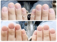 オー 町田モディ店(Oh!)/お爪改善！スカルプで長さ出し☆