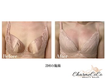 シャルムココ 蔵前店(CharmeCoCo)/お客様Before→After