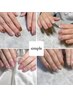 《ハンド》定額シンプルコース