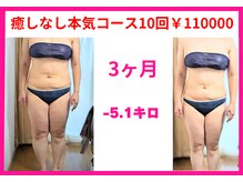 フレクシー/癒しなし本気コース10回