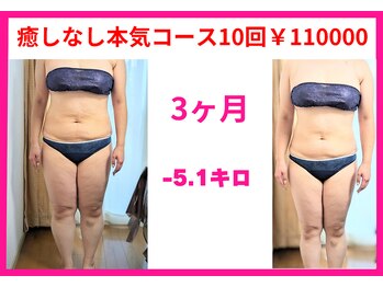 フレクシー/癒しなし本気コース10回