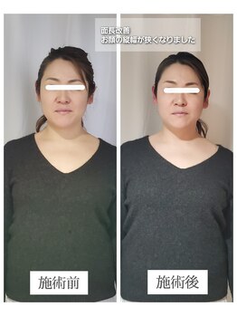 エクラ(eclat)/お客様の変化