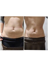 トータルビューティケア アヤ(Aya)/