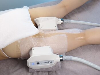 エステティックサロン フェアリー(ESTHETIC SALON FAIRLY)/【痩身】ハイスペック脂肪冷却