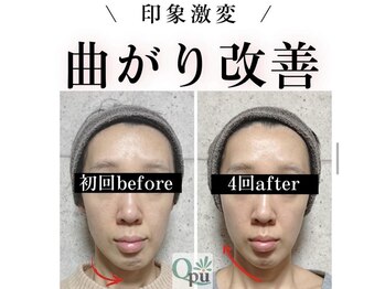 キュープ 高崎店(Qpu)/小顔頭蓋骨矯正＋リンパケア