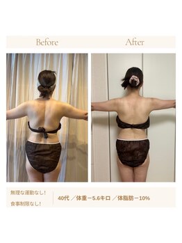 ヨサパーク ドゥー 駒沢公園(YOSA PARK deux)/痩身/ダイエット/よもぎ蒸し痩身